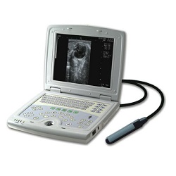 portable 2D digital laptop ultrasound scanner CCB-5000