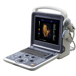 portable 4D color doppler ultrasound CCB-K2