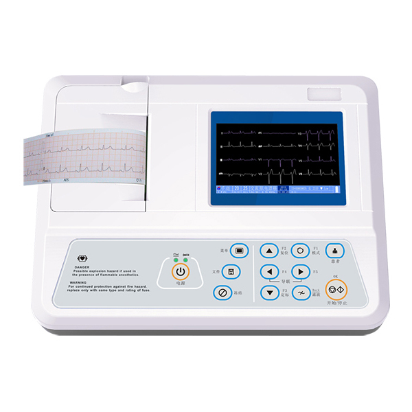 ECG