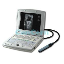 portable 2D digital laptop ultrasound scanner CCB-5000V