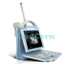 Portable 2d b/w digital laptop ultrasound CCB-5600V