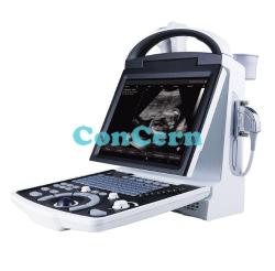 Portable B/W ultrasound scanner CCHY5533