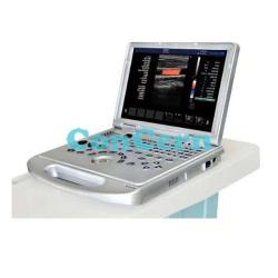 Laptop Color Doppler Ultrasound Scanner CCDW-L5