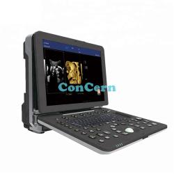 Portable color ultrasound scanner for sale CCDW-P6