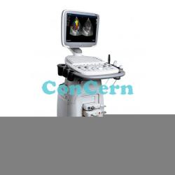 Trolley Color Doppler Ultrasound system USG 15-inch High-Resolution Color LCD SonoScape S11