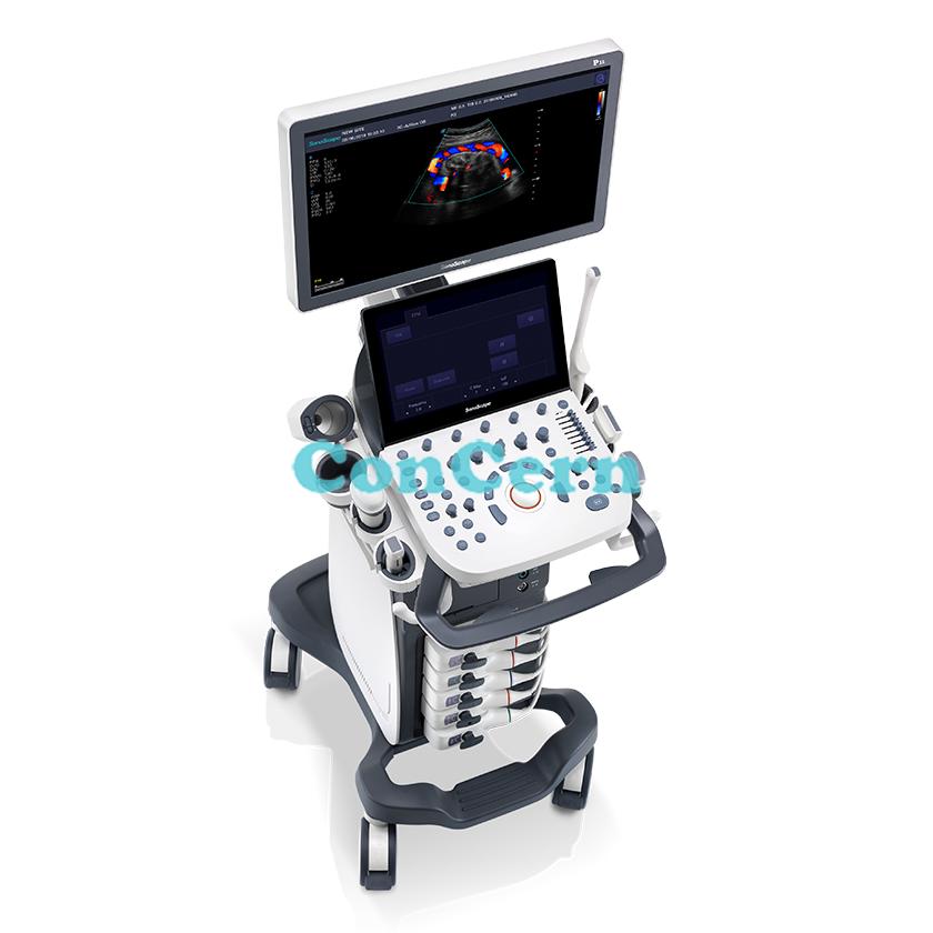 High quality colour Doppler ultrasound scanning machine  SonoScape P15