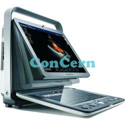 Portable Color Doppler ultrasound machine SonoScape S9