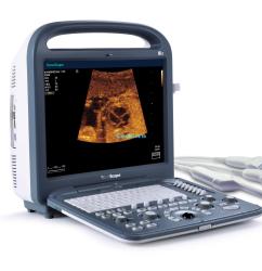 Portable 3D cheap ultrasound machine for sale Sonoscape S2