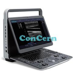 Medical ultrasound system black and white ultrasound SonoScape E1