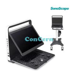 Latest Wholesale 3D 4D Color Doppler Ultrasound Portable Sonoscape E2