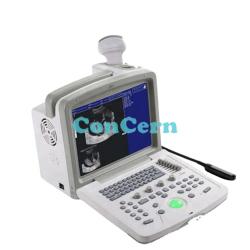 Portable Black And White Ultrasound Scanner CCB180