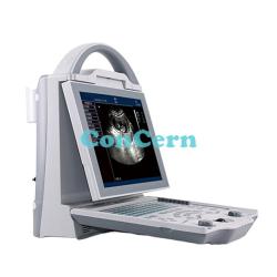 Portable 2d b/w digital laptop ultrasound CCB-5600