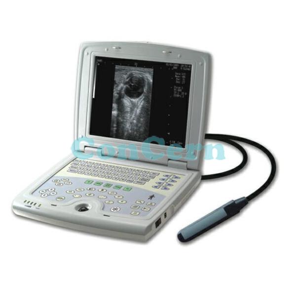 CCB-5000Vportable 2D digital laptop ultrasound scanner CCB-5000V