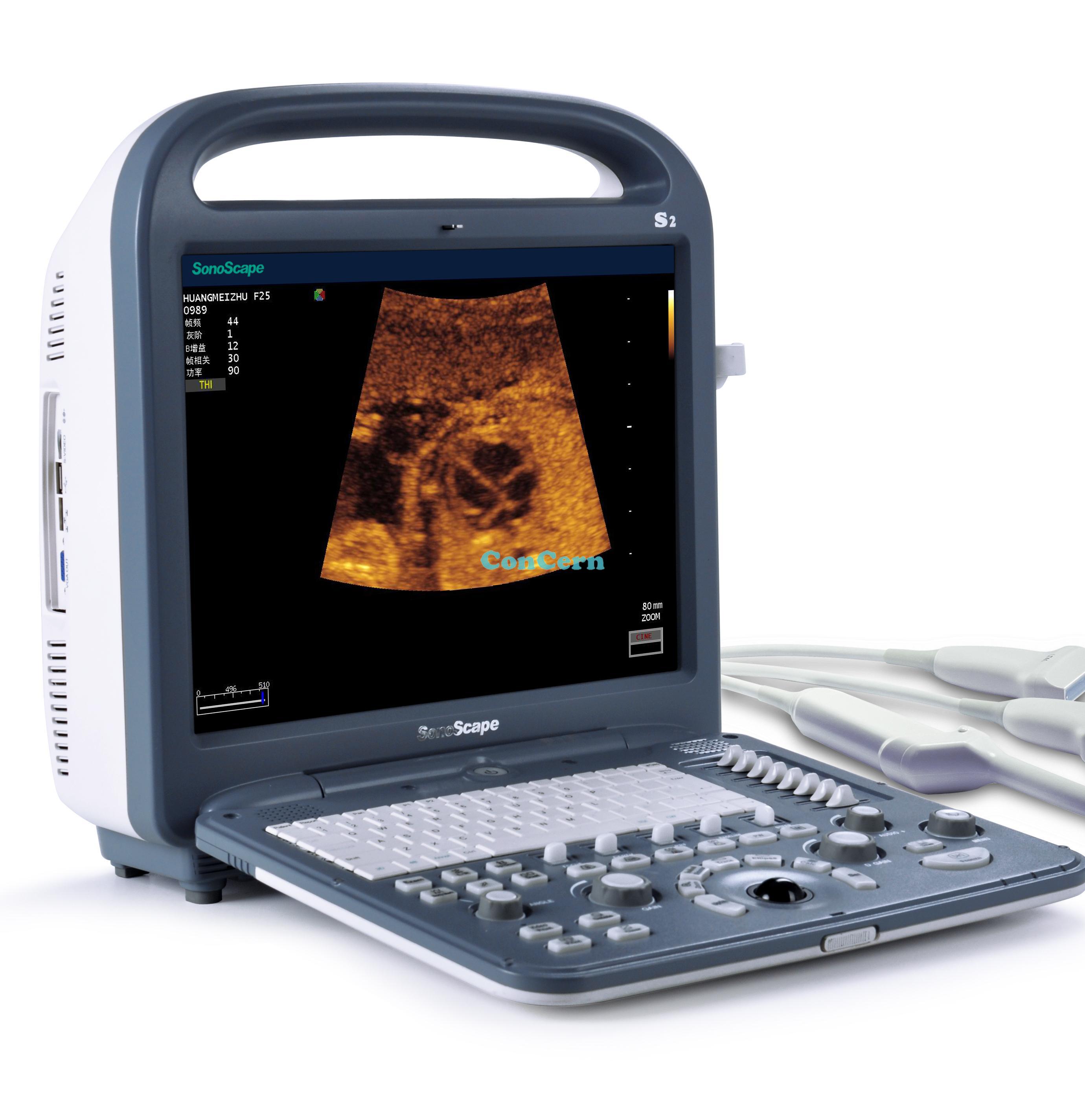 Sonoscape S2Portable 3D cheap ultrasound machine for sale Sonoscape S2