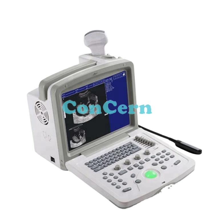 CCB180Portable Black And White Ultrasound Scanner CCB180